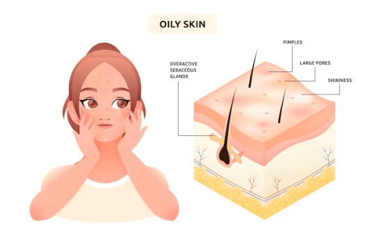 A Importância do Tônico na Rotina de Pele&nbsp;Oleosa